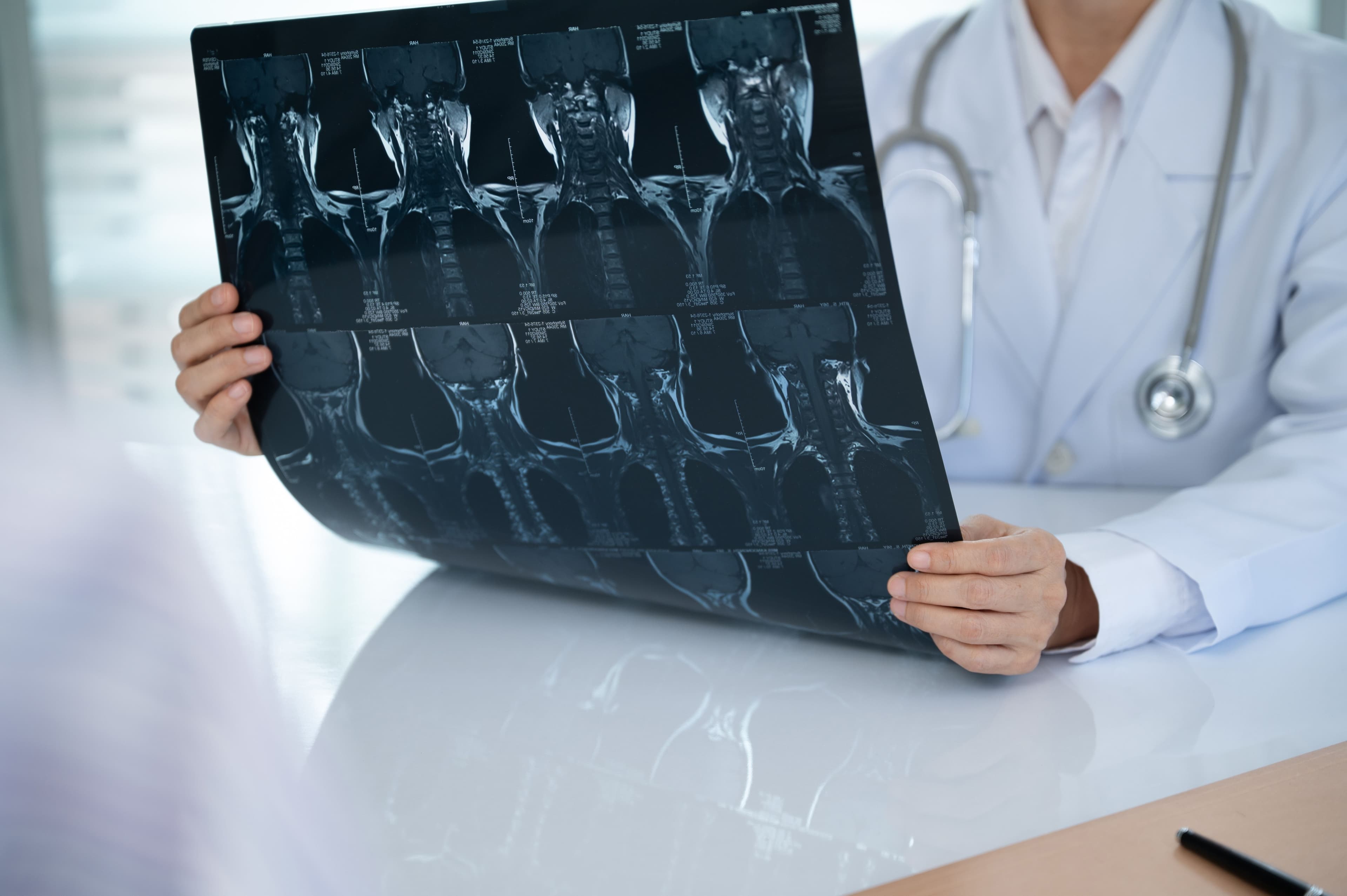 Spinal Injuries